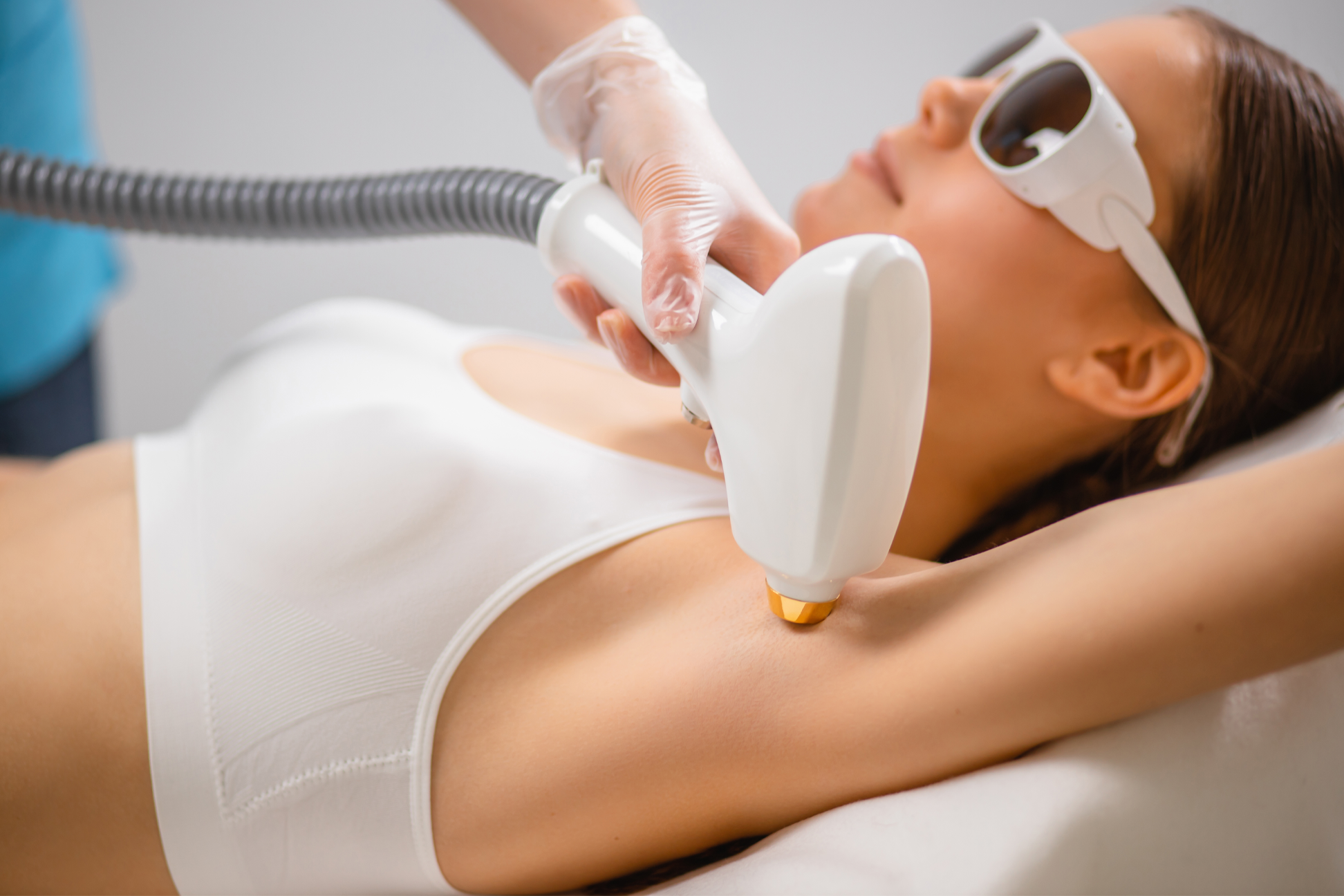 Blanqueamiento Laser Axilas Aclarar Axilas Antes Quitar Manchas De