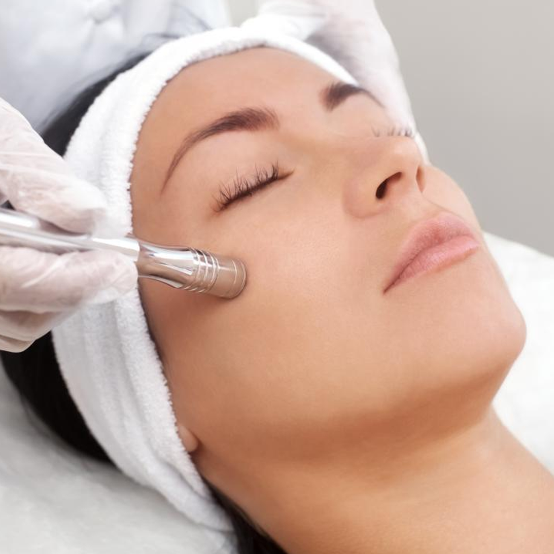 Microdermabrasión Facial