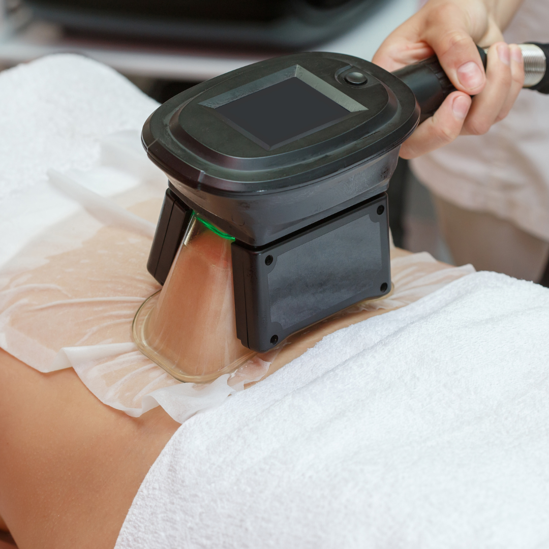 Crio Lipo abdomen superior o inferior