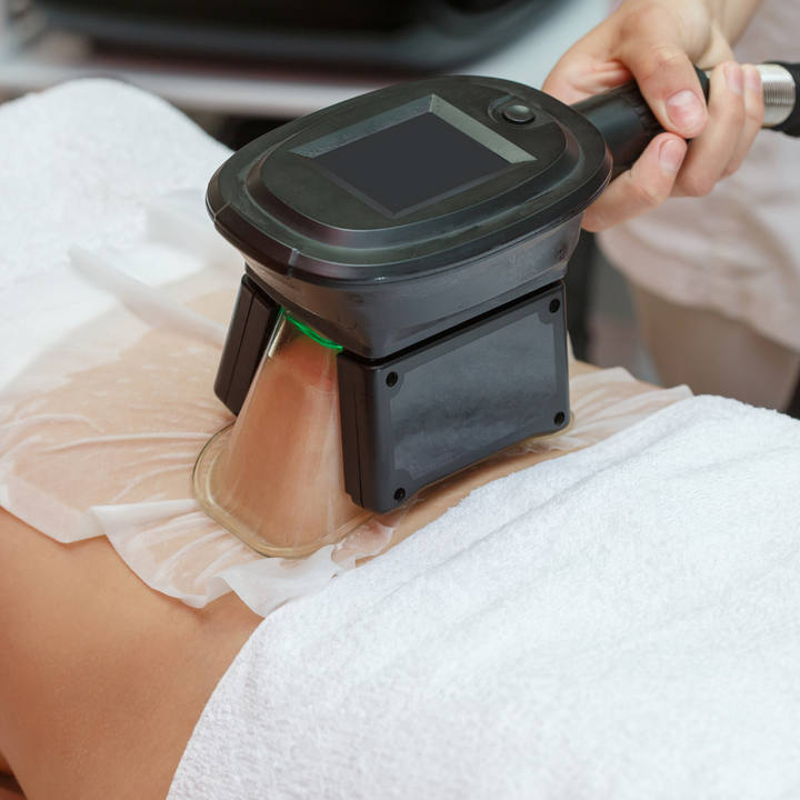 Crio Lipo abdomen superior o inferior