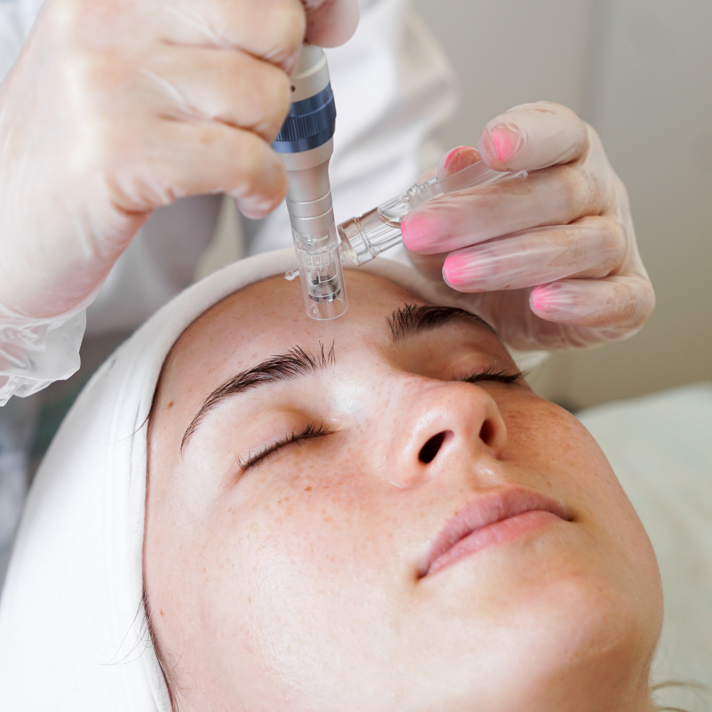 Micro agujas Facial